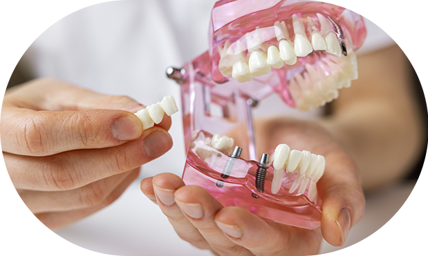 dental-place-osteoenswmatosi-color