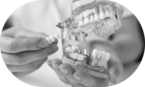 dental-place-osteoenswmatosi